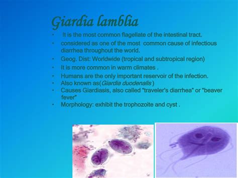 Giardia! Ontdek de Microscopische Wereld van Deze Flagellaat en Zijn Onverwachte Reisdoor het Dierenrijk