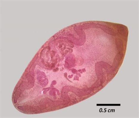  Paragonimus Westermani: Een Parasiet Met Een Voorkeur voor Longen En De Gedachte Aan Recepturen!